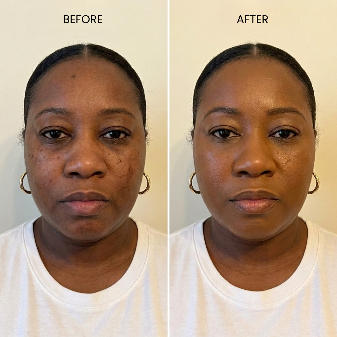 Before & After
