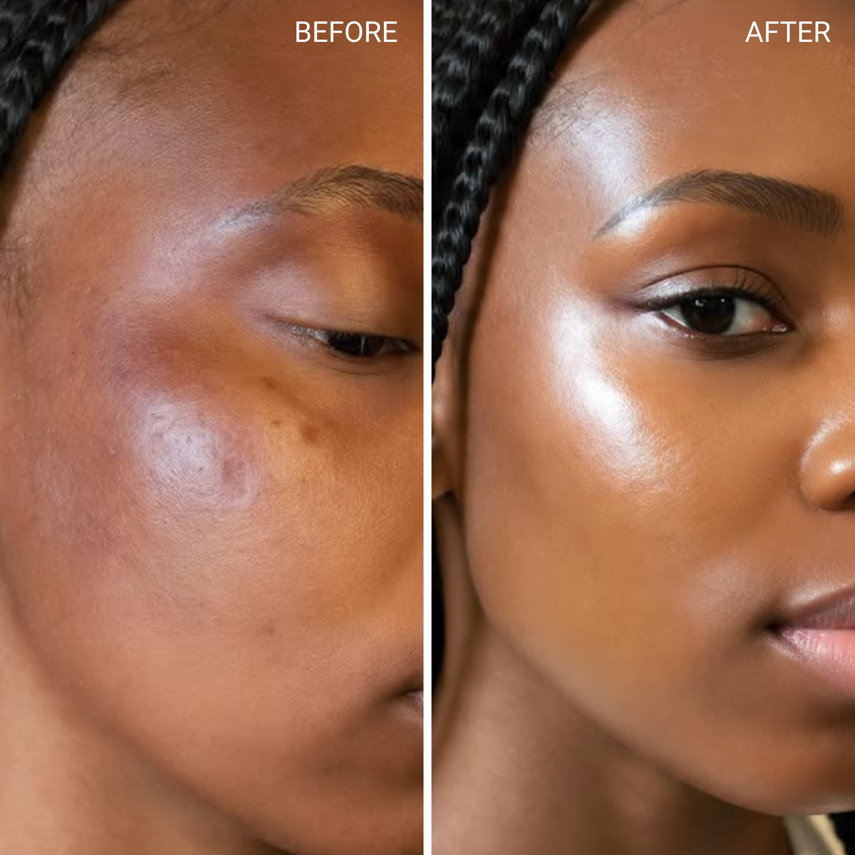 Before & After