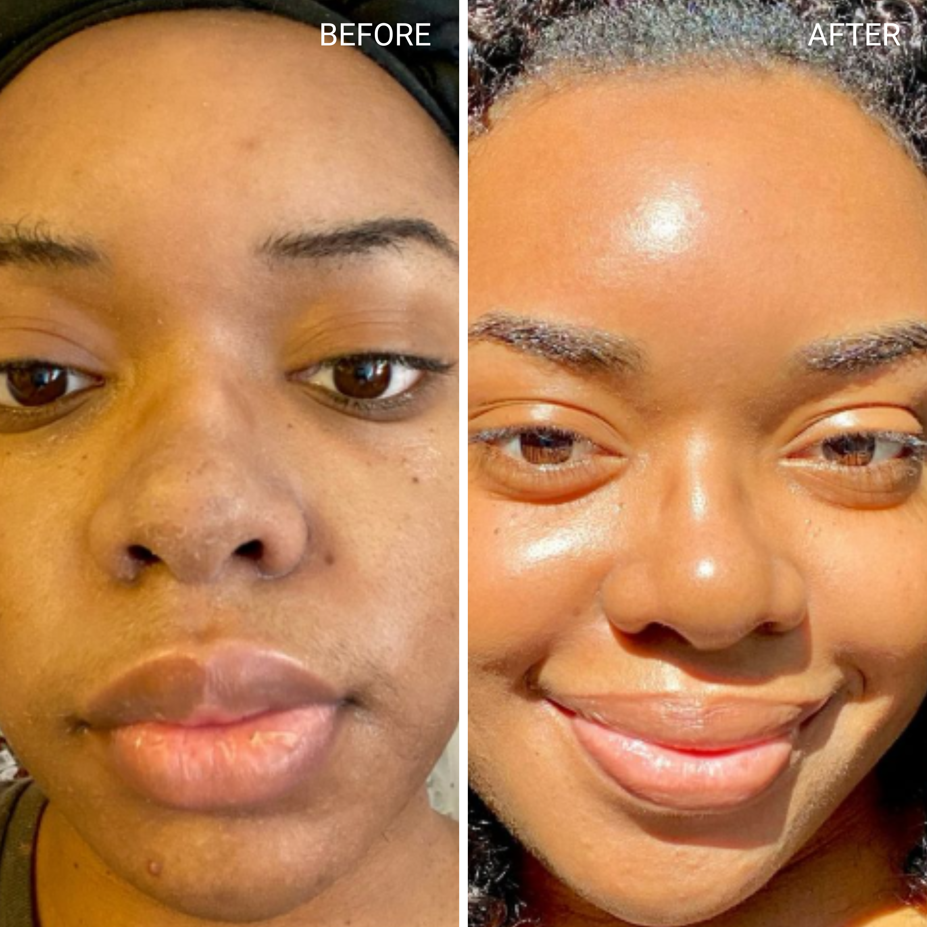 Before & After