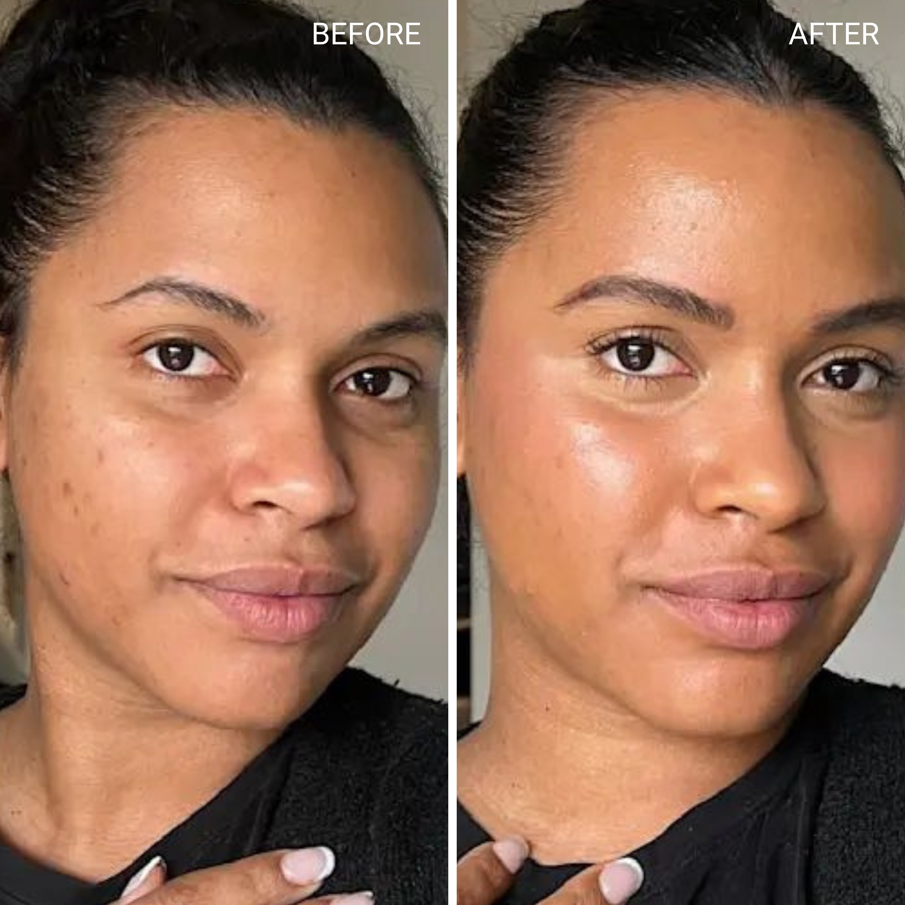 Before & After