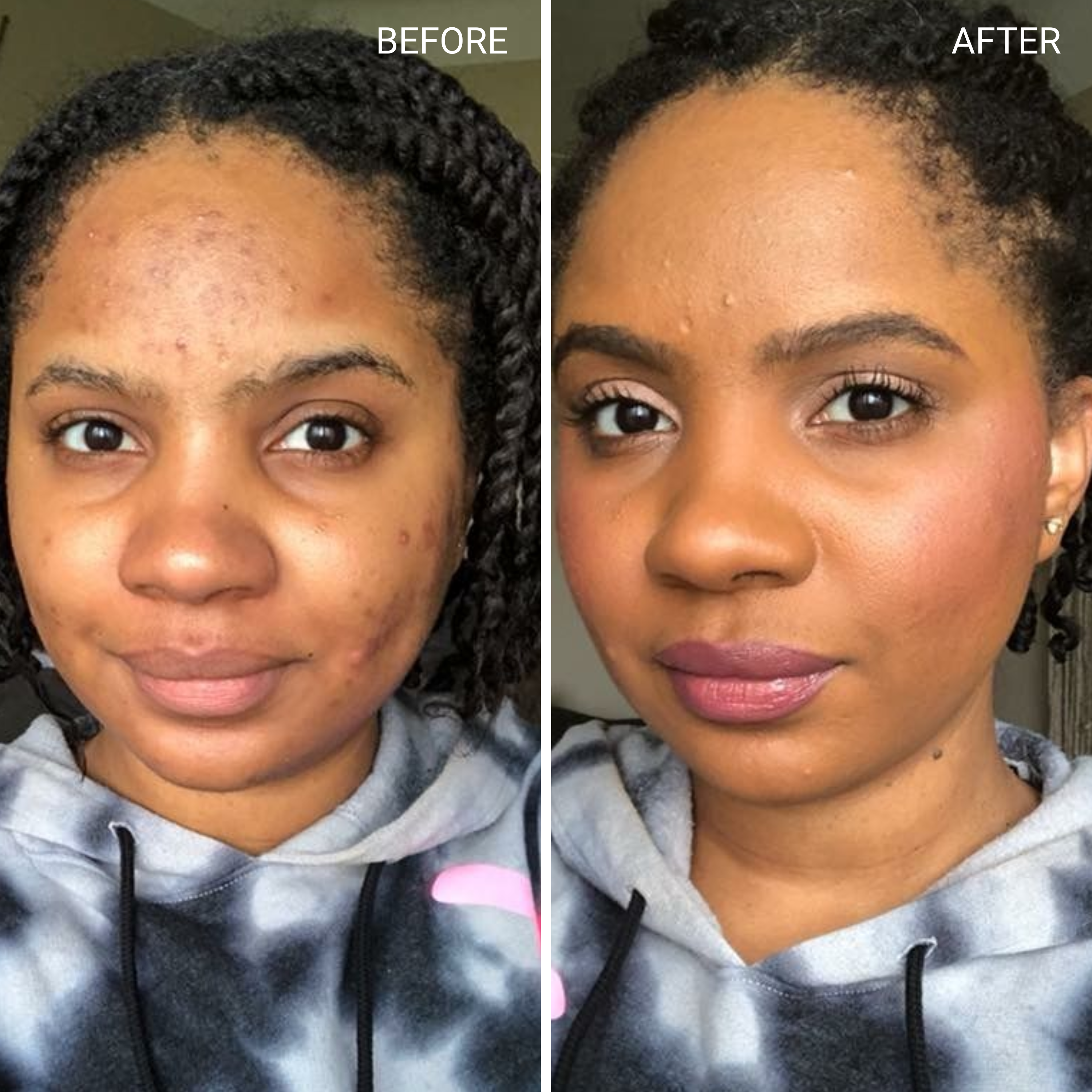 Before & After