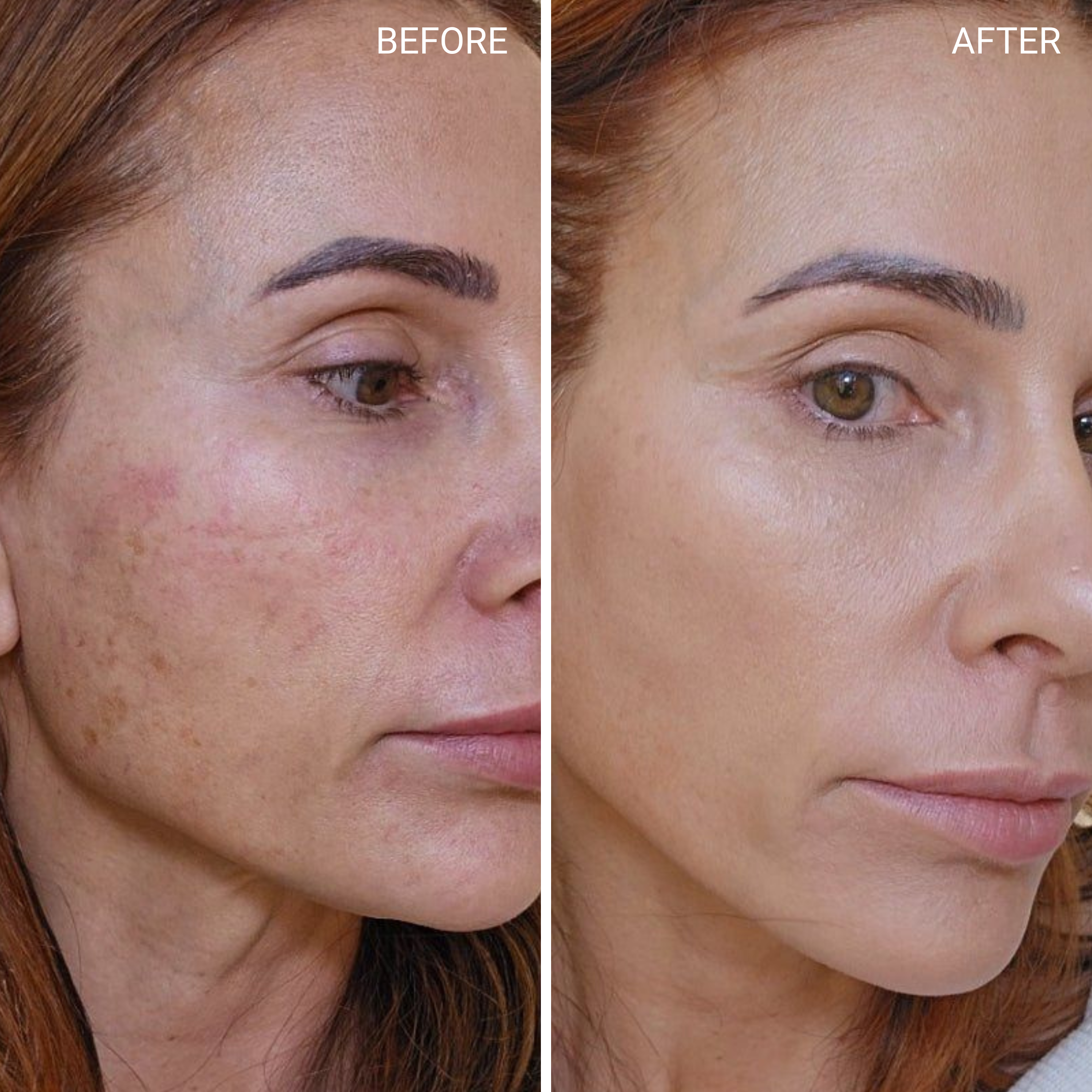 Before & After
