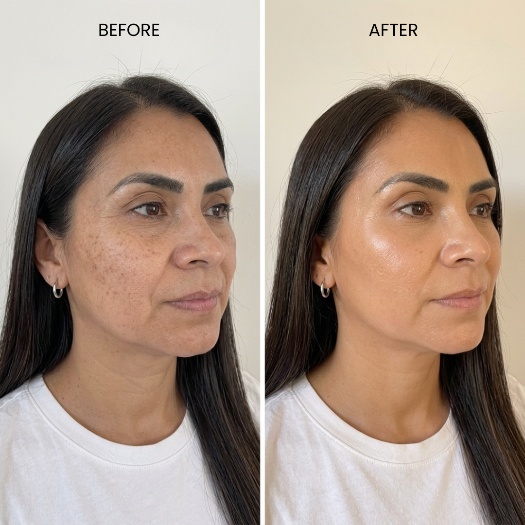 Before & After