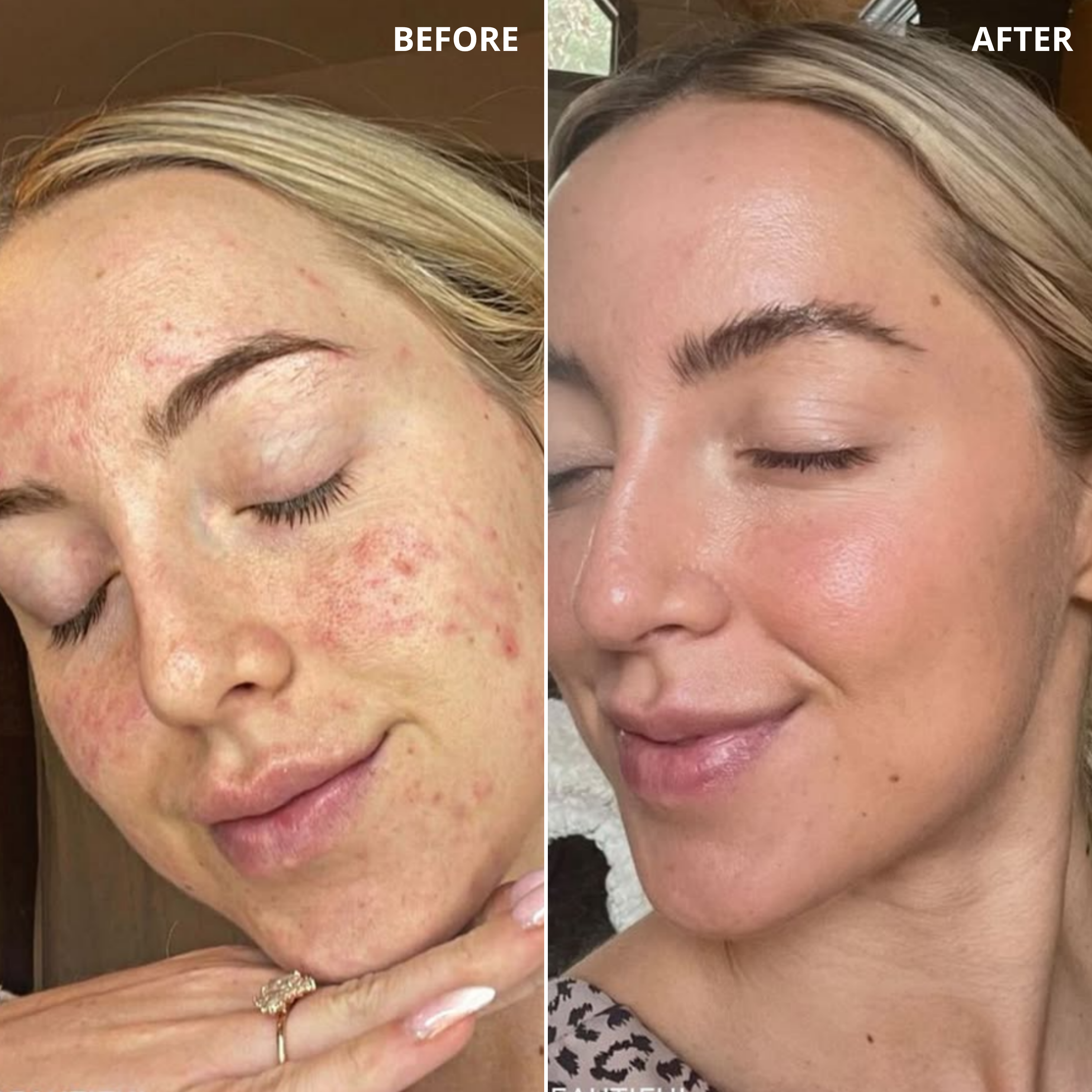 Before & After