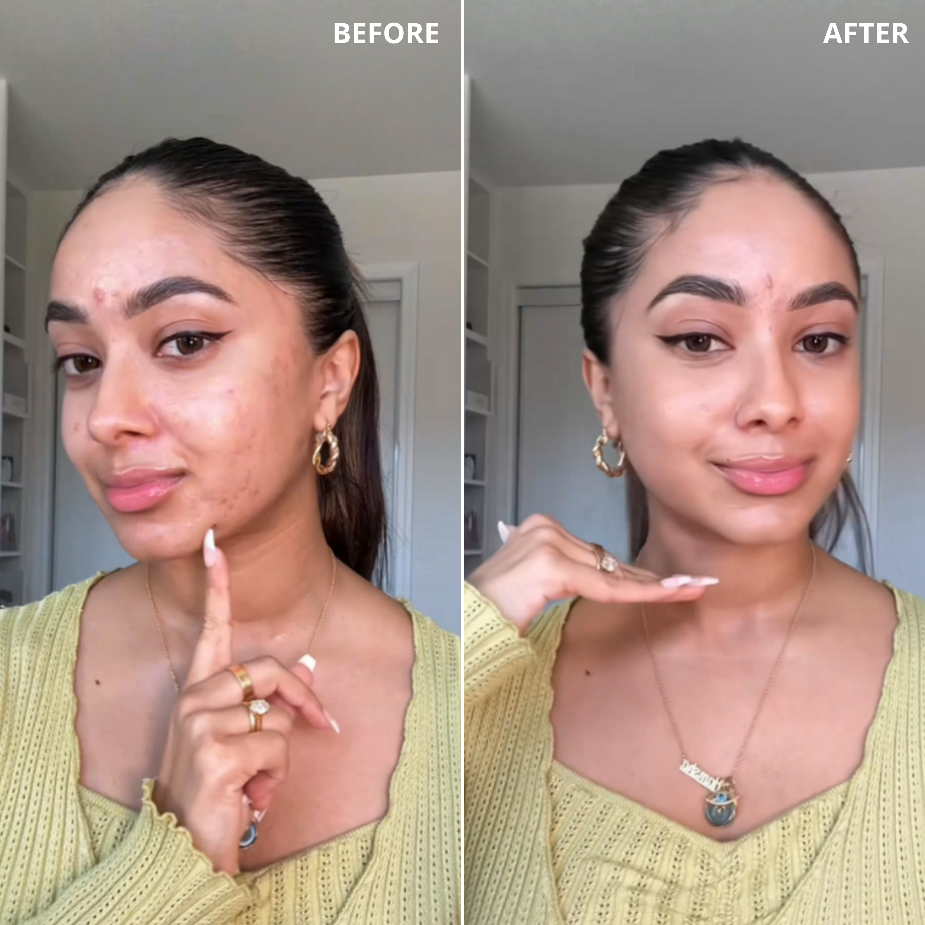 Before & After