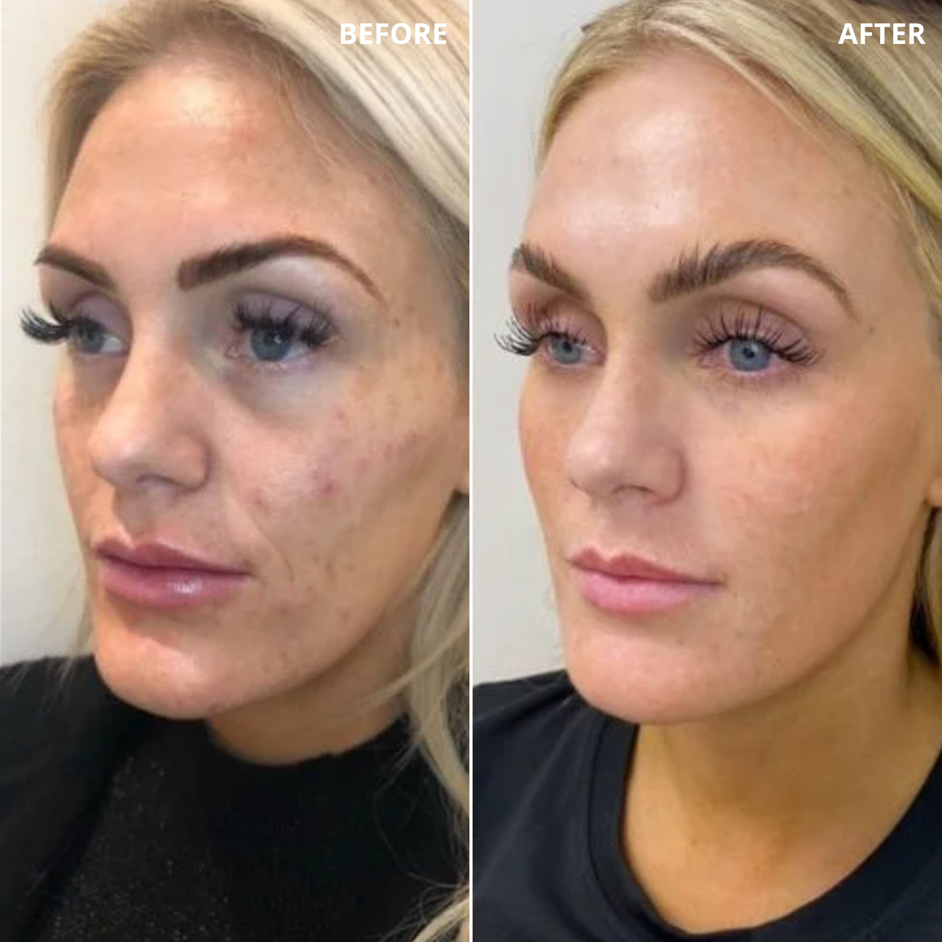 Before & After