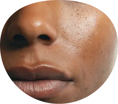 Dull, Tired-Looking Skin