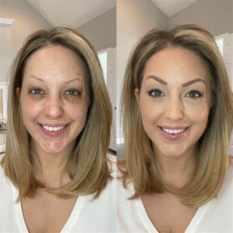 Before & After
