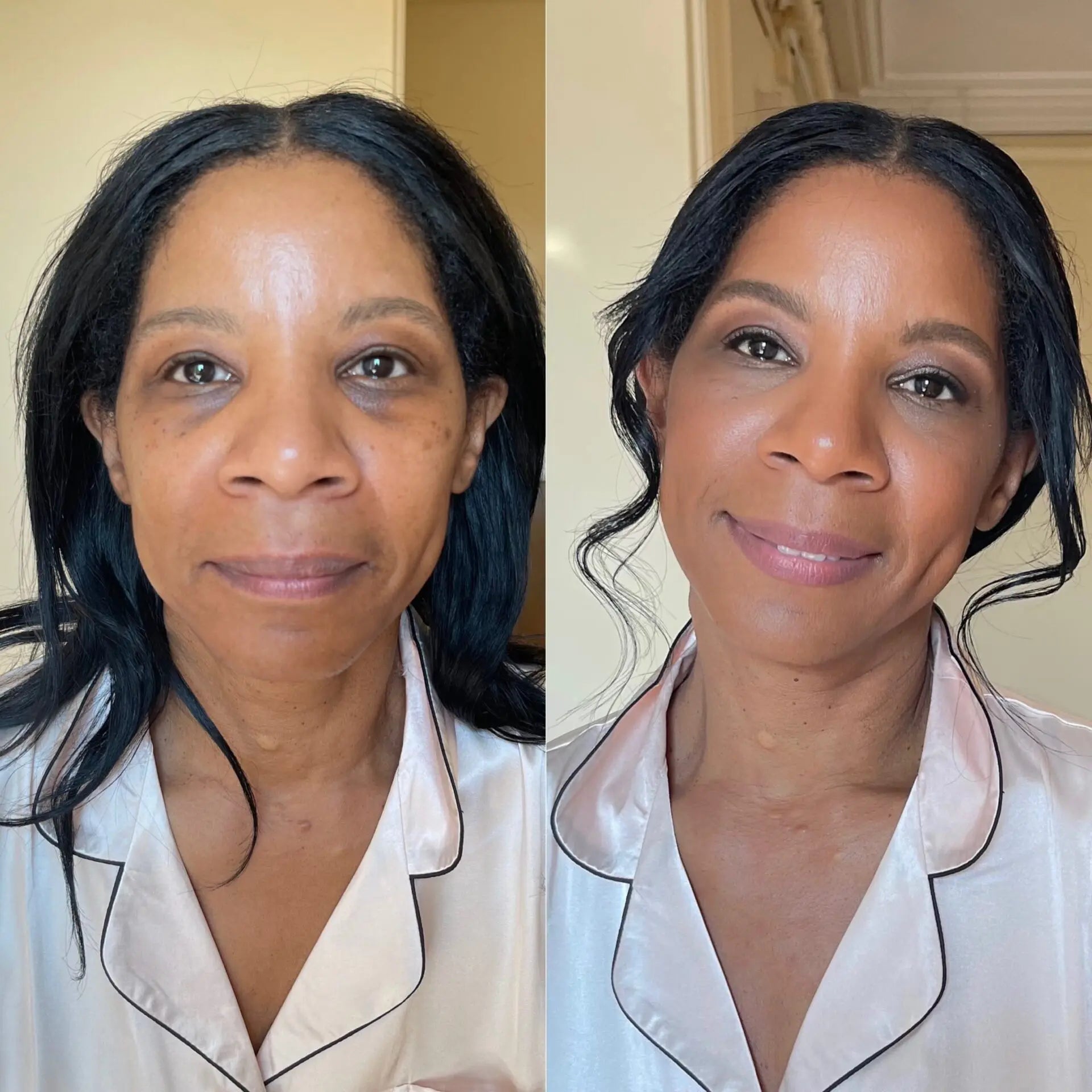 Before & After